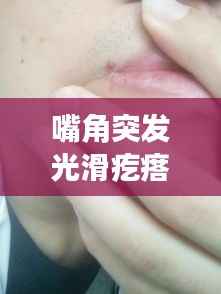 嘴角突发光滑疙瘩,嘴角有凸起的疙瘩