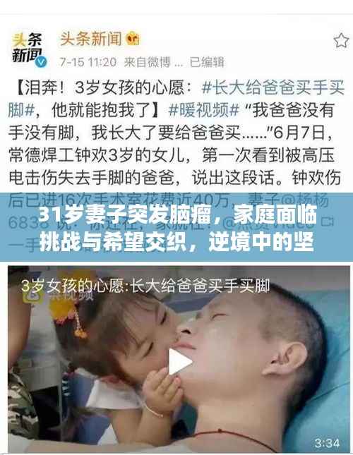 31岁妻子突发脑瘤，家庭面临挑战与希望交织，逆境中的坚守与希望之旅